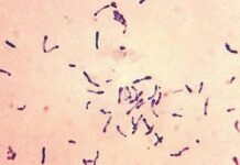 Salud Pública emite alerta epidemiológica por casos de difteria