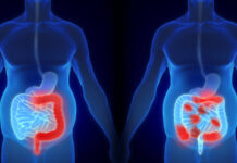 Descubren una causa de enfermedad inflamatoria intestinal: la interacción entre bacterias y células de la capa de moco