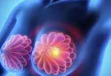 Estudia revela que las células pueden reprogramarse para combatir el cáncer de mama